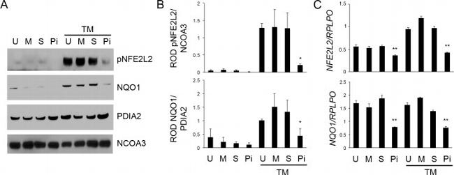 SRC3 Antibody in Western Blot (WB)