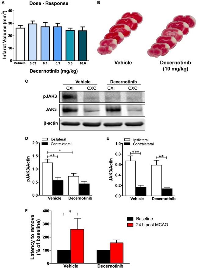 JAK3 Antibody in Western Blot (WB)