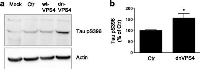 Phospho-Tau (Ser396) Antibody in Western Blot (WB)