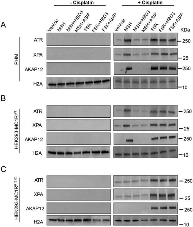 AKAP12 Antibody in Western Blot (WB)