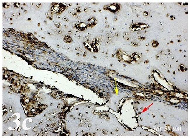 Osteopontin Antibody in Immunohistochemistry (IHC)