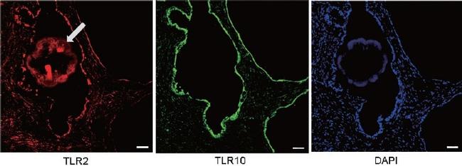 TLR10 Antibody in Immunocytochemistry, Immunohistochemistry (ICC/IF, IHC)