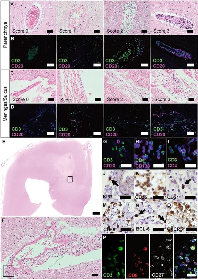 Ki-67 Antibody in Immunohistochemistry (IHC)