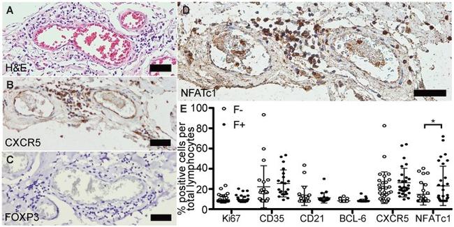 Ki-67 Antibody in Immunohistochemistry (IHC)