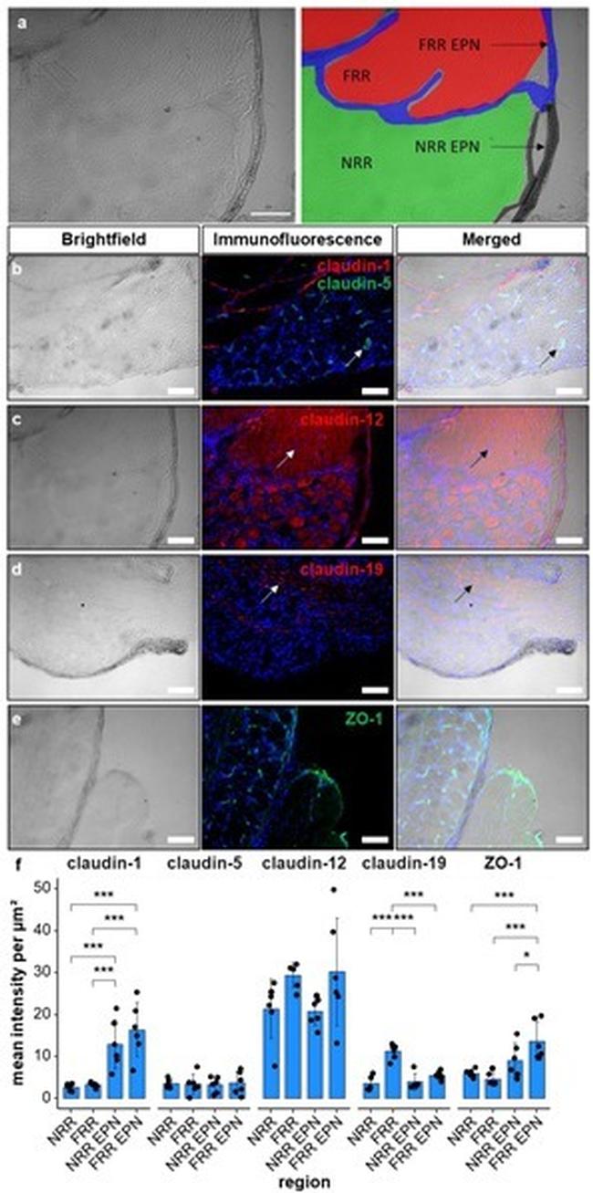 Claudin 5 Antibody in Immunohistochemistry (IHC)