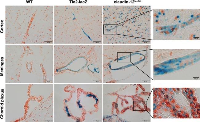 beta Galactosidase Antibody in Immunohistochemistry (IHC)