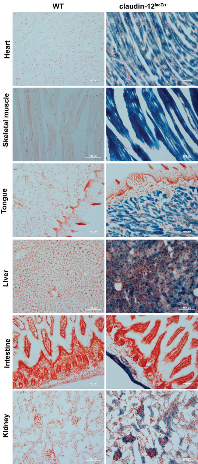 beta Galactosidase Antibody in Immunohistochemistry (IHC)