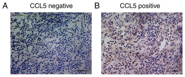 CCL5 (RANTES) Antibody in Immunohistochemistry (IHC)