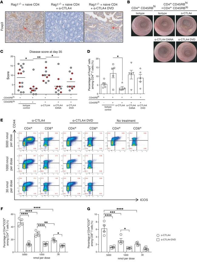 FOXP3 Antibody in Immunohistochemistry (IHC)