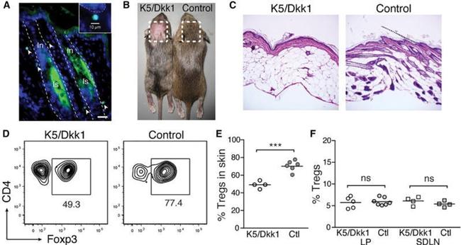 FOXP3 Antibody in Immunohistochemistry (IHC)