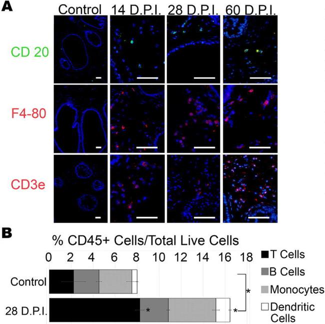 CD20 Antibody in Immunocytochemistry, Immunohistochemistry (ICC/IF, IHC)