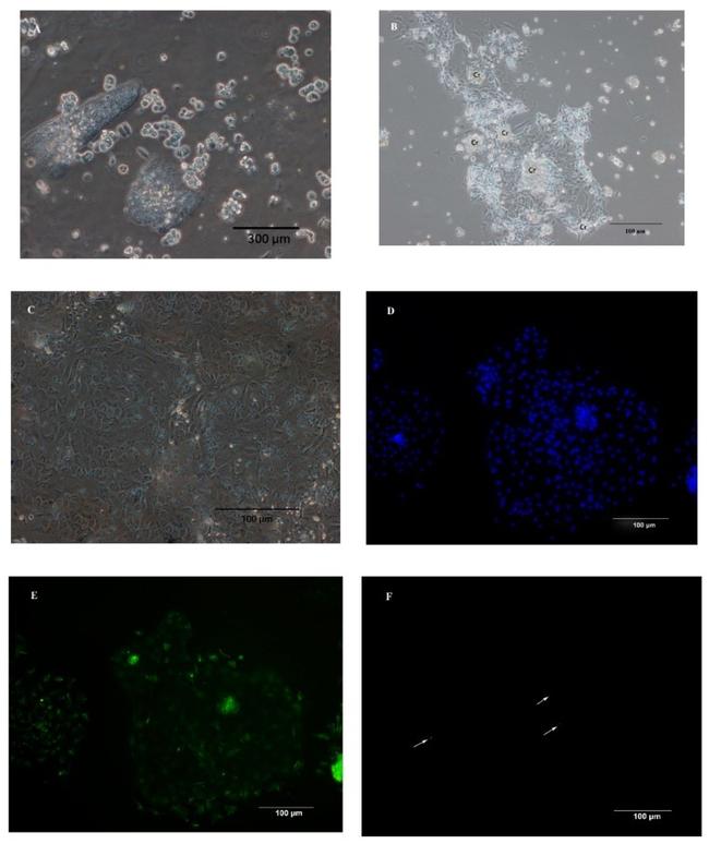 Cytokeratin 18 Antibody in Immunocytochemistry (ICC/IF)