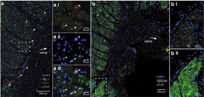 SSEA4 Antibody in Immunohistochemistry (IHC)