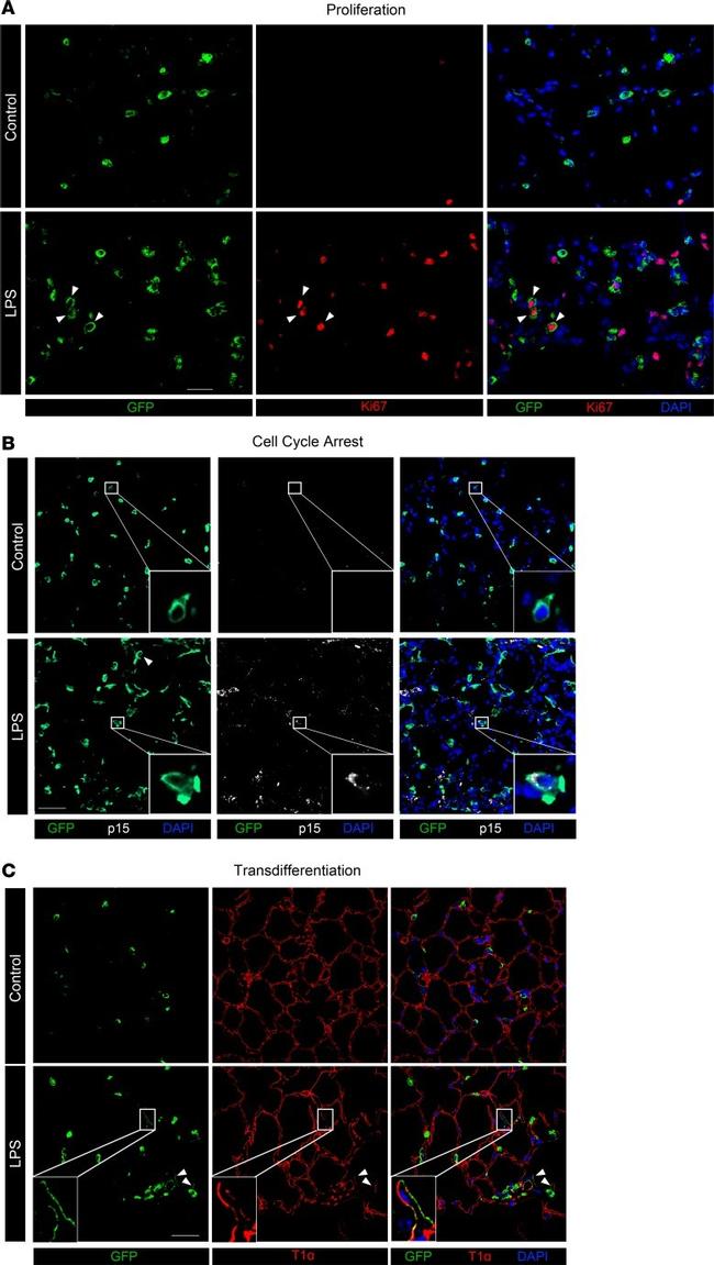 Podoplanin Antibody in Immunocytochemistry (ICC/IF)