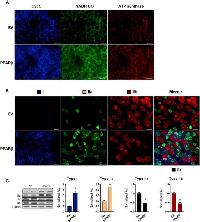 NDUFA9 Antibody in Immunocytochemistry (ICC/IF)