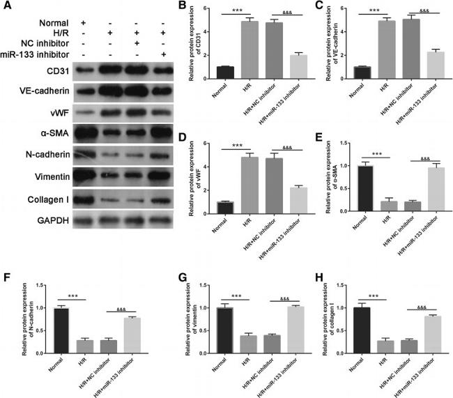 Alpha-Smooth Muscle Actin Antibody in Western Blot (WB)