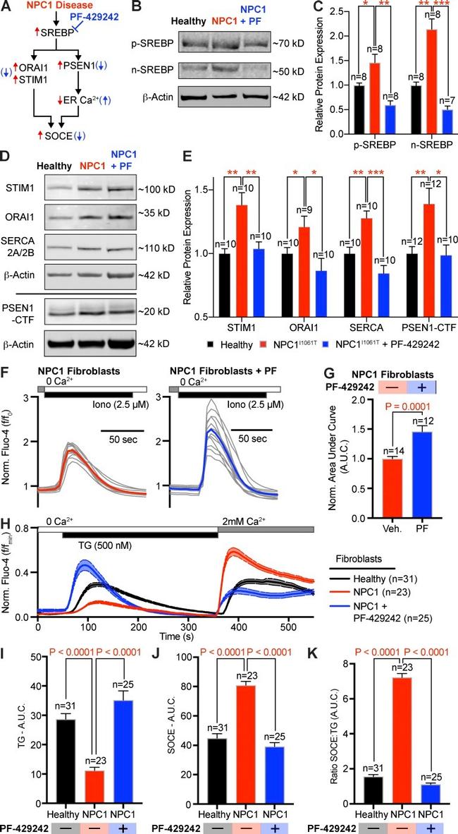 SREBP1 Antibody in Western Blot (WB)