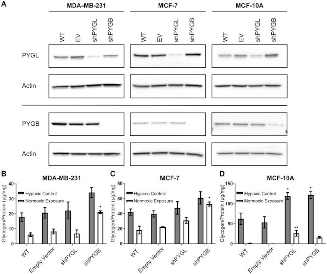 GPBB Antibody in Western Blot (WB)