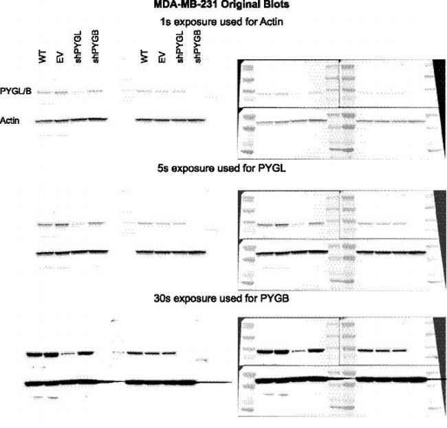 PYGL Antibody in Western Blot (WB)