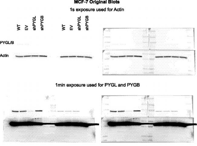 PYGL Antibody in Western Blot (WB)