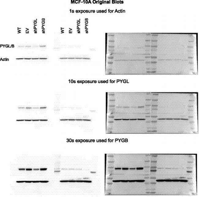 PYGL Antibody in Western Blot (WB)