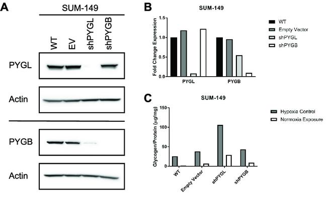 PYGL Antibody in Western Blot (WB)