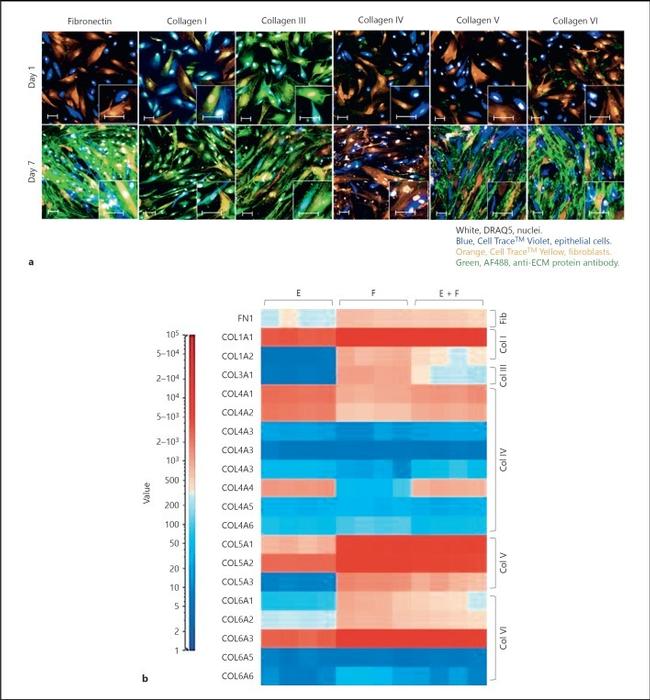 Collagen IV Antibody in Immunocytochemistry (ICC/IF)