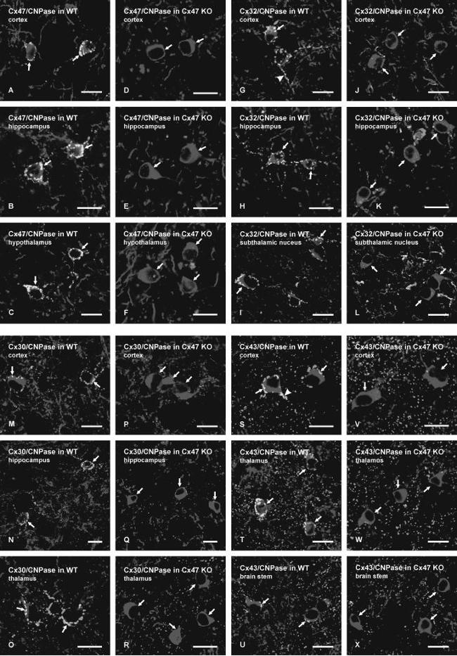 Connexin 32 Antibody in Immunohistochemistry (IHC)