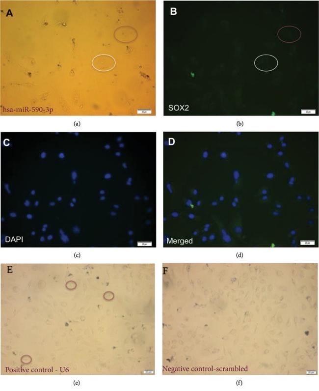 SOX2 Antibody in Immunocytochemistry (ICC/IF)