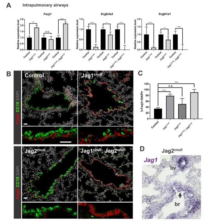 FOXJ1 Antibody in Immunohistochemistry (IHC)