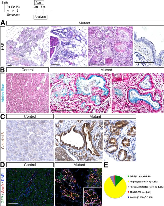 Claudin 18 Antibody in Immunohistochemistry (IHC)