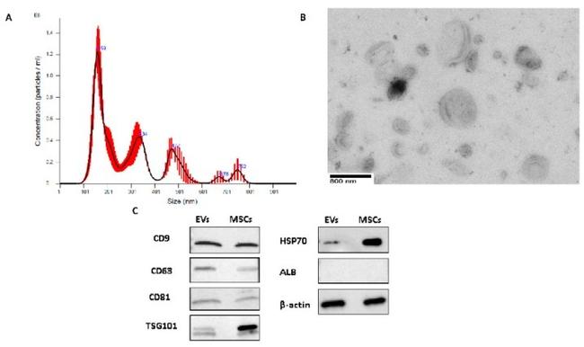 TSG101 Antibody in Western Blot (WB)