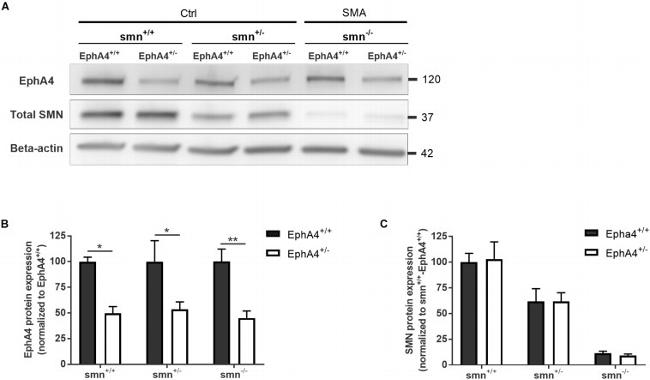 EphA4 Antibody in Western Blot (WB)