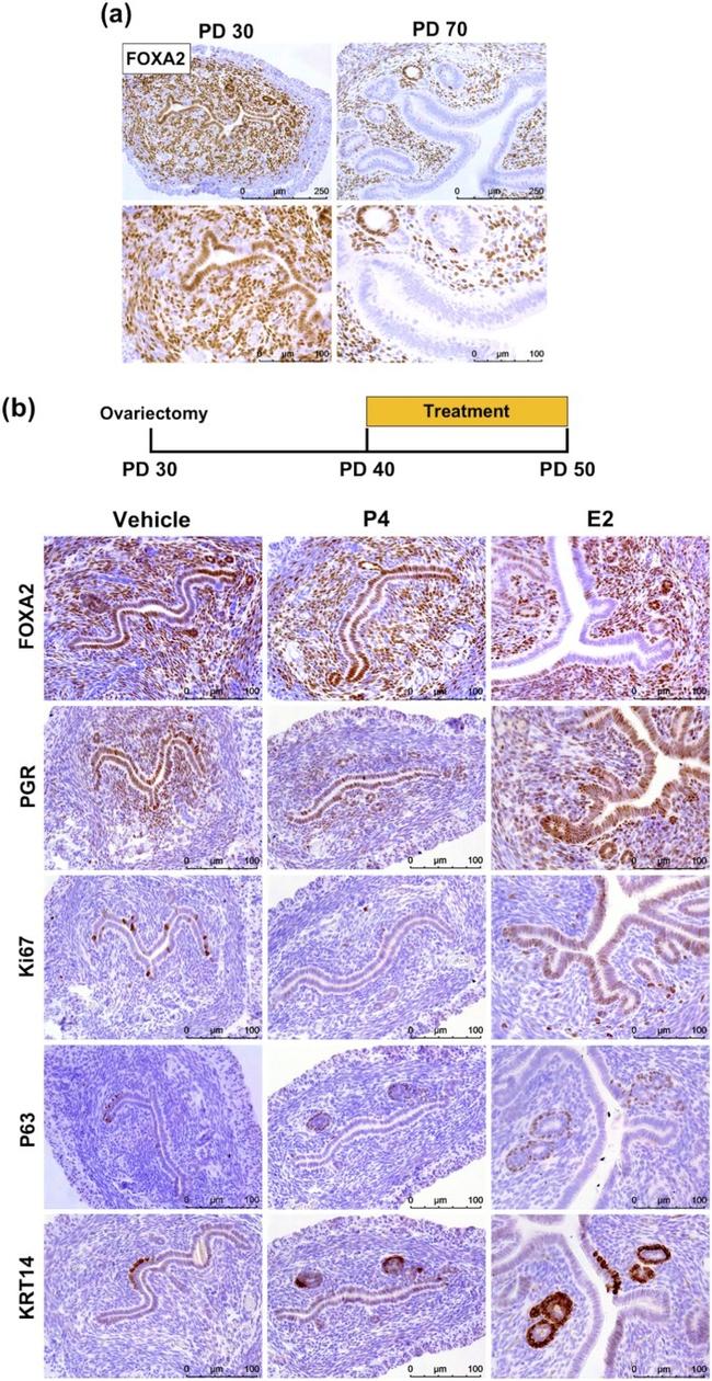 Progesterone Receptor Antibody in Immunohistochemistry (IHC)