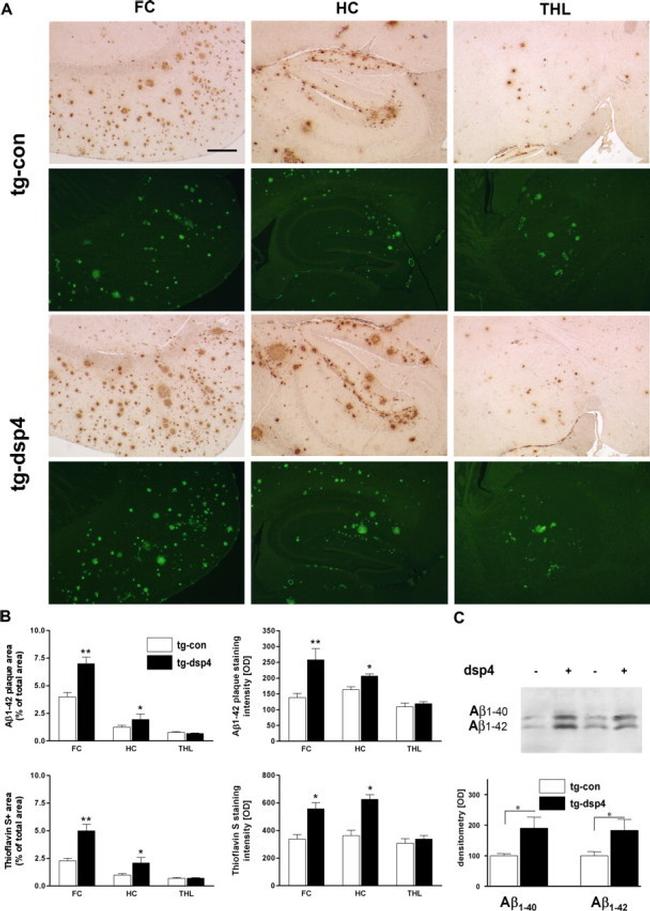 beta Amyloid (1-42) Antibody in Immunohistochemistry (IHC)