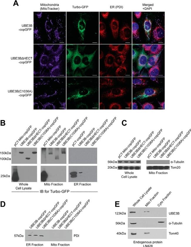 PDI Antibody in Immunocytochemistry (ICC/IF)