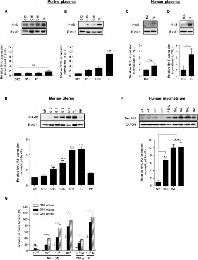 GAPDH Antibody in Western Blot (WB)