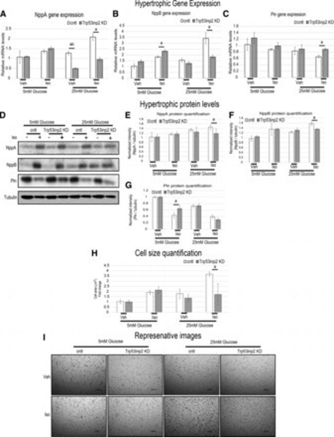 BNP Antibody in Western Blot (WB)