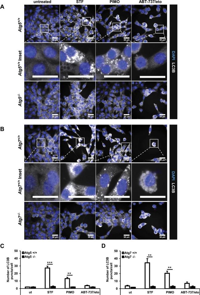 LC3B Antibody in Immunocytochemistry (ICC/IF)