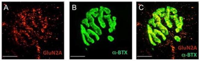 NMDAR2A Antibody in Immunocytochemistry, Immunohistochemistry (ICC/IF, IHC)