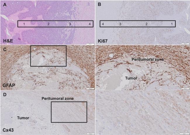 GFAP Antibody in Immunohistochemistry (IHC)