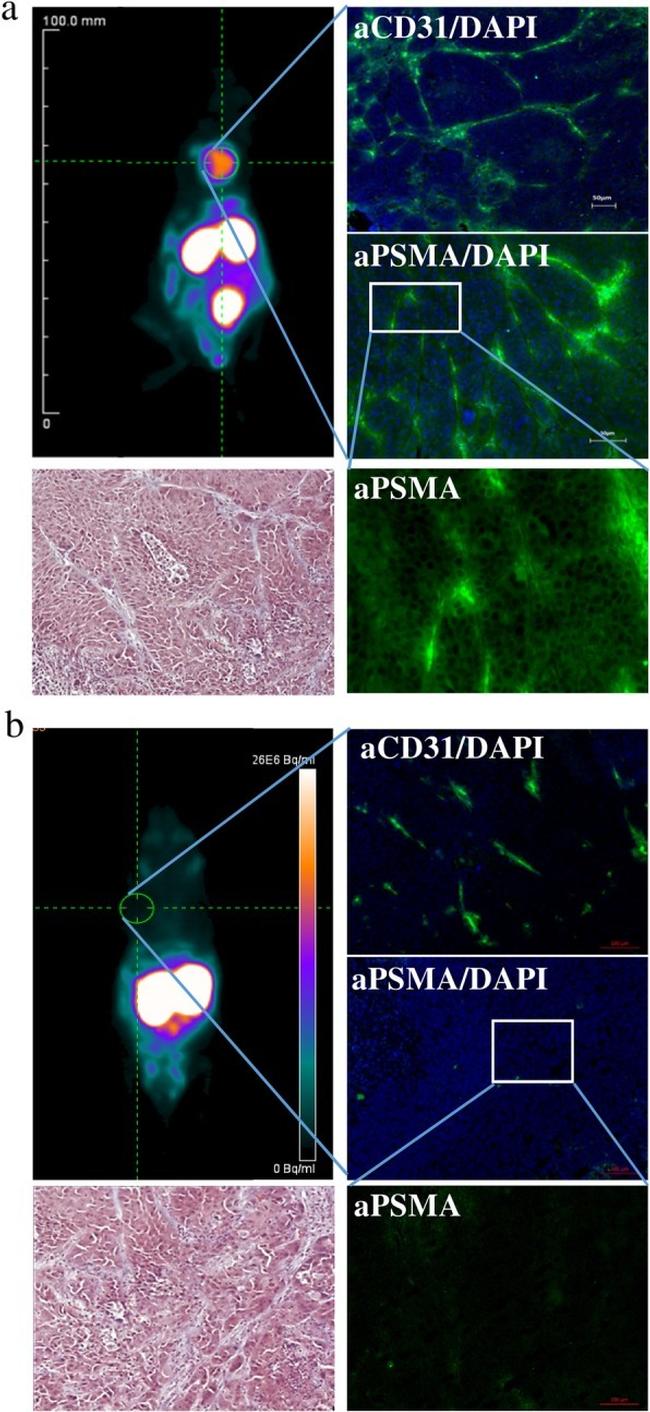 CD31 Antibody in Immunohistochemistry (IHC)