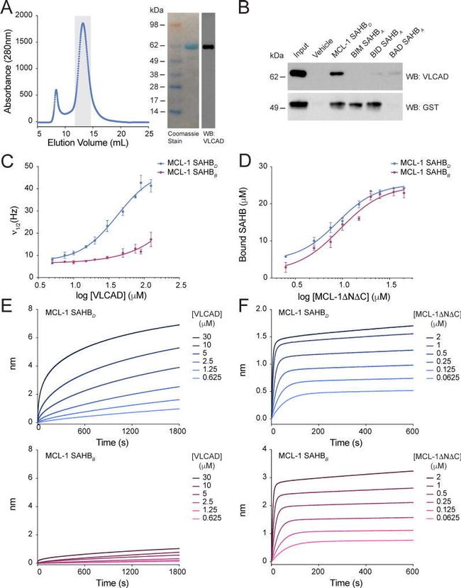 ACADVL Antibody in Western Blot (WB)