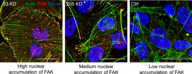 FAK Antibody in Immunocytochemistry (ICC/IF)