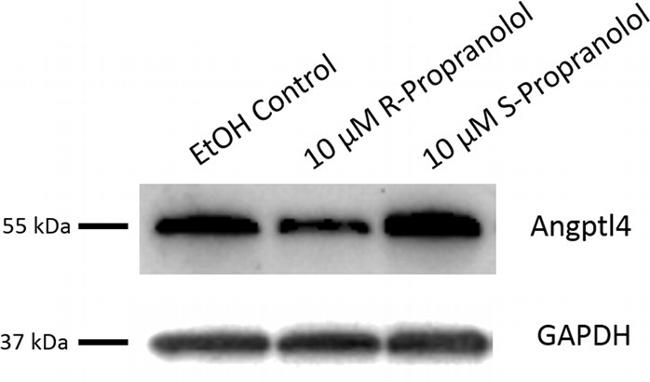 ANGPTL4 Antibody in Western Blot (WB)