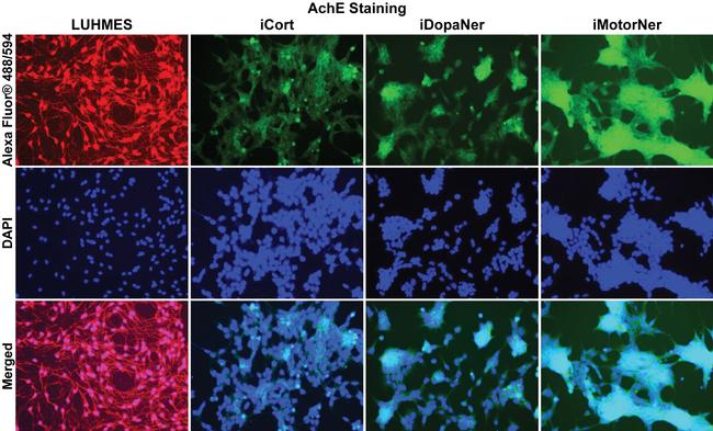 Acetylcholinesterase Antibody in Immunocytochemistry (ICC/IF)