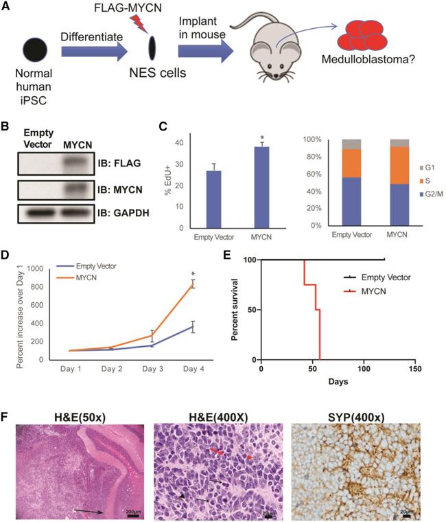 Synaptophysin Antibody in Immunohistochemistry (IHC)