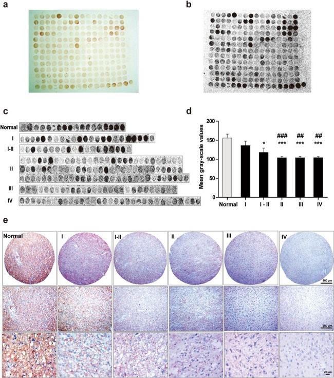 ATP1B2 Antibody in Immunohistochemistry, Peptide array (IHC, ARRAY)