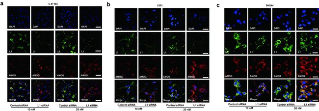 ATP1B2 Antibody in Immunocytochemistry, Immunohistochemistry (ICC/IF, IHC)