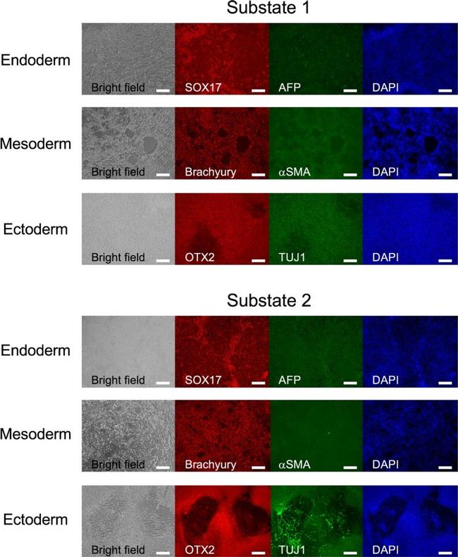 OTX2 Antibody in Immunocytochemistry, Immunohistochemistry (ICC/IF, IHC)